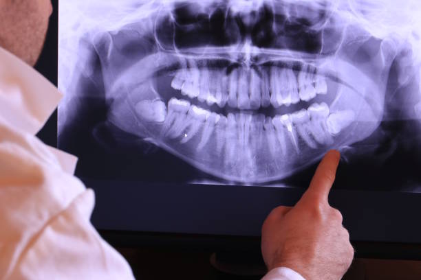 Best Chipped Tooth Repair Near Me  in Elkader, IA