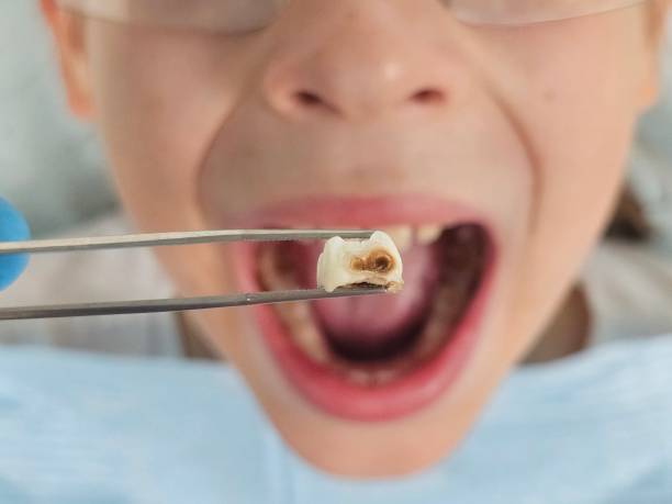 Best Emergency Pediatric Dentist  in Elkader, IA